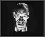 Rondo Hatton, a famous sufferer of acromegaly whose face was distorted by the disorder.