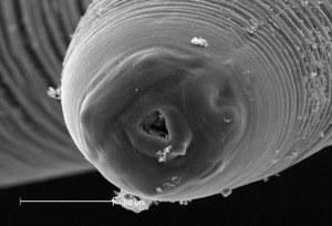 A scanning electron micrograph of the mouthparts of Anisakis simplex
