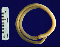 An adult female Ascaris worm.