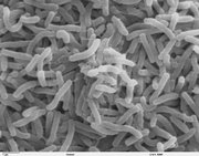 Vibrio cholerae: The bacteria that causes cholera (SEM image)
