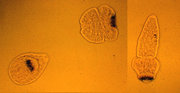 Echinococcus organisms taken from a hydatid cyst