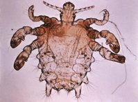 A magnified crab louse