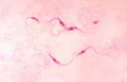Photomicrograph of Giemsa-stained Trypanosoma cruzi crithidia (CDC)