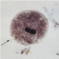 A trophozoite of Balantidium coli