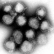 Negatively stained flu virions. These were the causative agent of the Hong Kong Flu pandemic. 