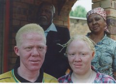 African albino brother & sister (parents in the back)