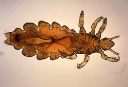 The head louse (Pediculus humanus var. capitis)