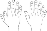 Drawing of a hand with one more thumb or finger than usual.