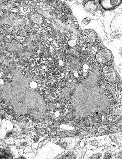 Micrograph with numerous rabies viruses (small dark-grey rod-like particles) and Negri bodies, larger cellular inclusions typical of Rabies infection