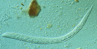 Strongyloides stercoralis. Source: CDC
