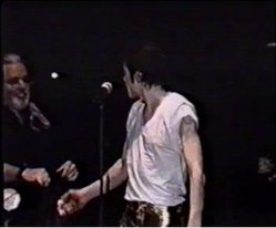 Singer/songwriter Michael Jackson suffers from vitiligo (see upper-arm)